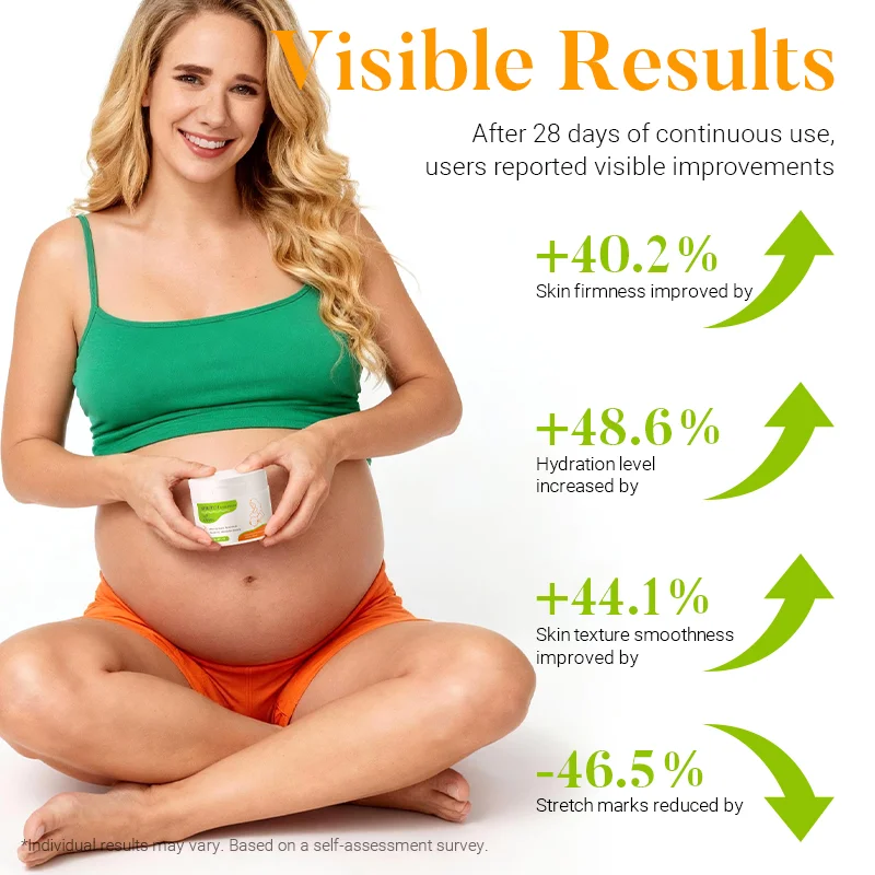 Private Label Stretch Mark Cream